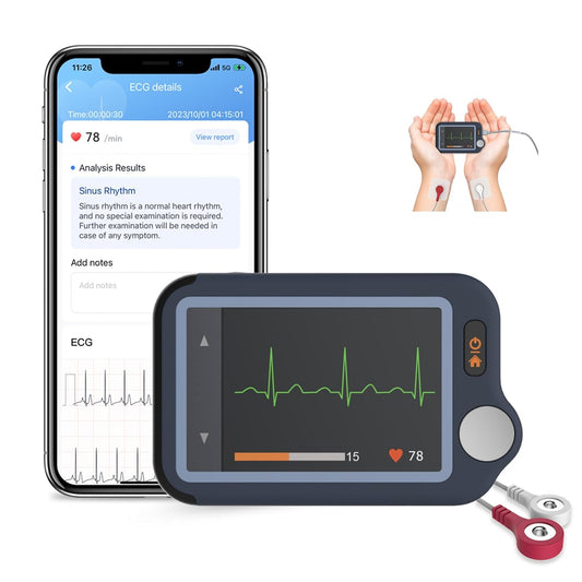 Portable ECG Monitor with Touch Screen, 30s/60s/5min ECG Recording, AI ECG Analysis, Home ECG Machine Supports Dual Users, Mobile Hearth Monitor, Unlimited Storage on Phone & PC