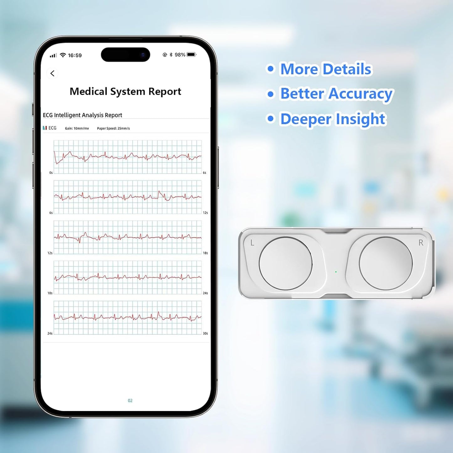 ECG Monitor, Portable ECG Monitor, Heart Rate Monitor Device for Home Use, Compatible with Smartphone，No Subscription