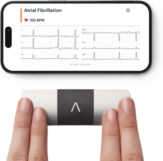 Smart Portable 6-Lead Personal ECG Heart Rate Monitor - Detects Atrial Fibrillation, Trusted by the NHS, Results in 30 Seconds, Works with Most Smartphones, Supporting British Heart Foundation