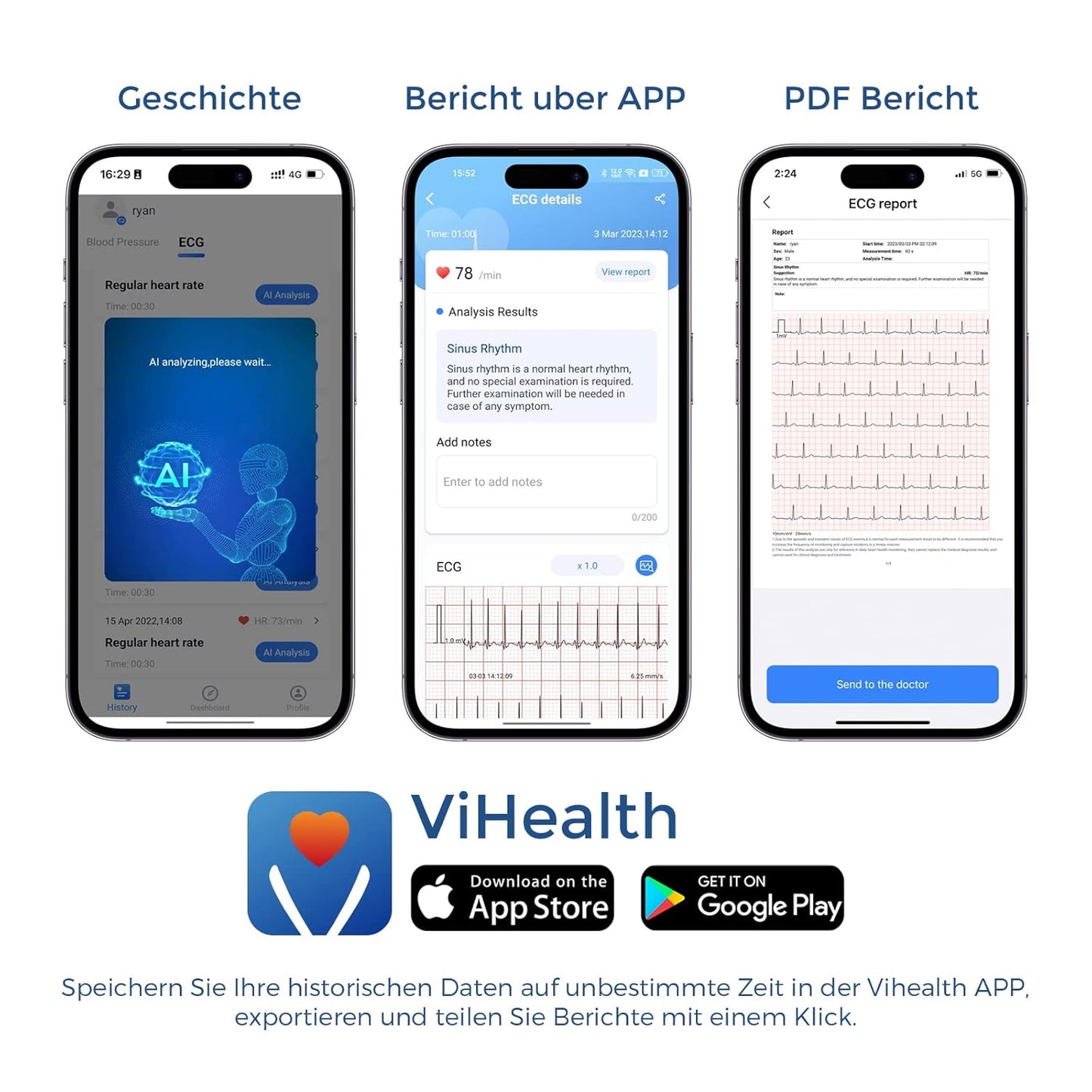 Portable ECG Monitor with Touch Screen, 30s/60s/5min ECG Recording, AI ECG Analysis, Home ECG Machine Supports Dual Users, Mobile Hearth Monitor, Unlimited Storage on Phone & PC