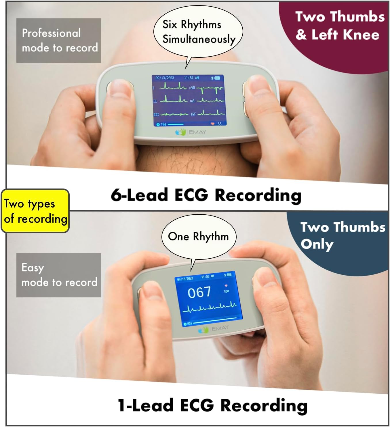 Portable 6-Lead ECG Monitor, Record ECG and Heart Rate in 6 Channels, Compatible with Smartphone and PC - No Subscription Required