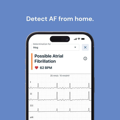 Smart Portable 6-Lead Personal ECG Heart Rate Monitor - Detects Atrial Fibrillation, Trusted by the NHS, Results in 30 Seconds, Works with Most Smartphones, Supporting British Heart Foundation