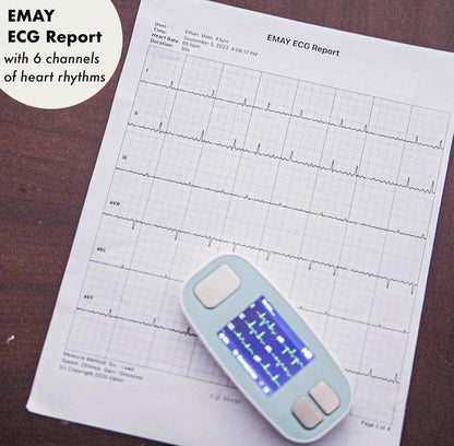 Portable 6-Lead ECG Monitor, Record ECG and Heart Rate in 6 Channels, Compatible with Smartphone and PC - No Subscription Required