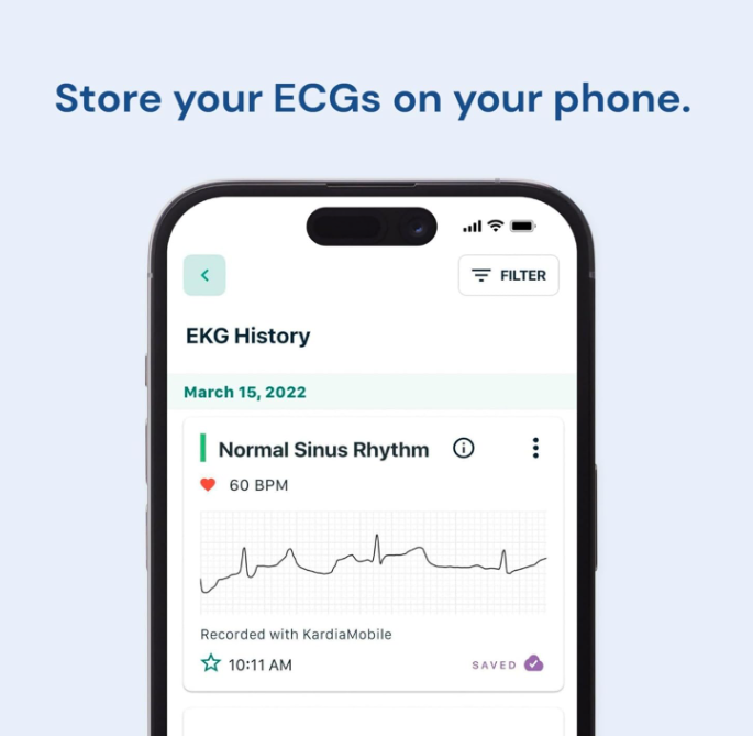 Portable Smart 1-Lead Personal ECG Heart Rate Monitor - Record ECGs at Home, Detects Atrial Fibrillation, Trusted by The NHS, Results in 30 Seconds, Works with Most Smartphones