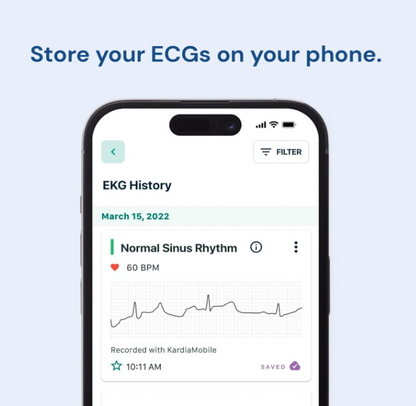 Portable Smart 1-Lead Personal ECG Heart Rate Monitor - Record ECGs at Home, Detects Atrial Fibrillation, Trusted by The NHS, Results in 30 Seconds, Works with Most Smartphones