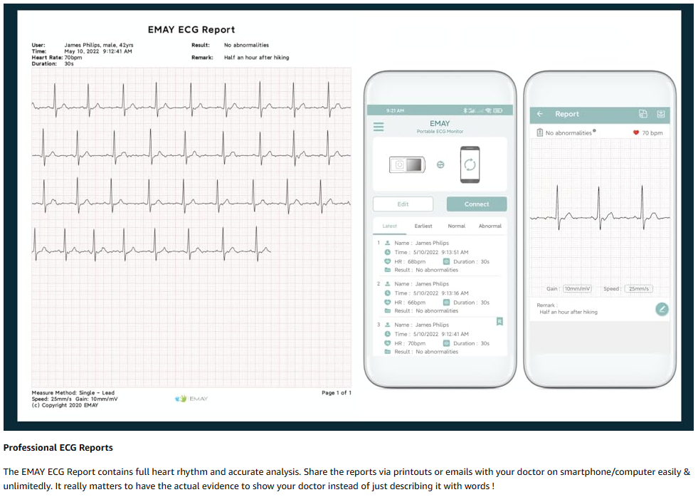 Portable ECG/EKG Monitor (Record ECG Without Smartphone) | Standalone Personal ECG Device with Screen & Data Storage | No Subscription Required