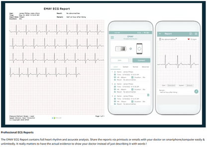 Portable ECG/EKG Monitor (Record ECG Without Smartphone) | Standalone Personal ECG Device with Screen & Data Storage | No Subscription Required