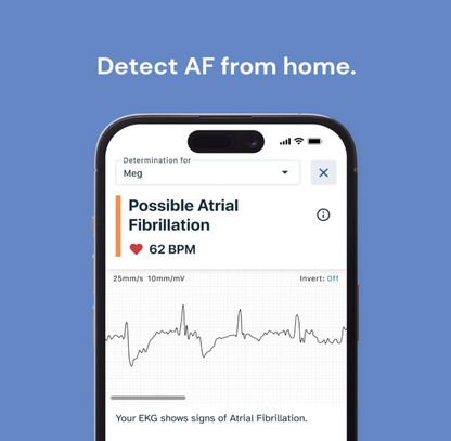 Portable Smart 1-Lead Personal ECG Heart Rate Monitor - Record ECGs at Home, Detects Atrial Fibrillation, Trusted by The NHS, Results in 30 Seconds, Works with Most Smartphones
