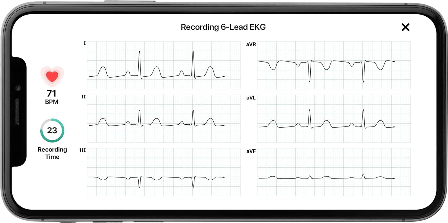 Portable ECG Monitor Bluetooth EKG Heart Tracker Device Accurate Fast Results 6-Lead with AFib Detection