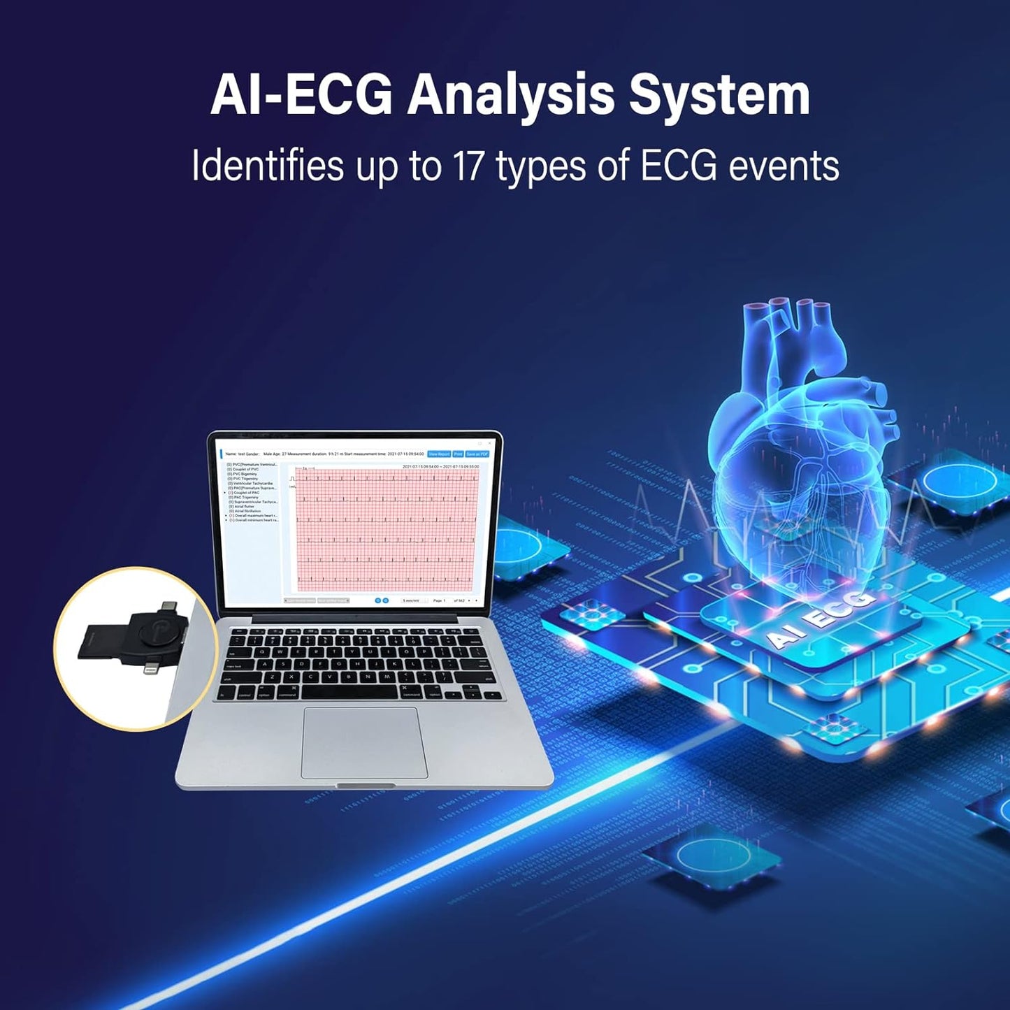 Professional ECG Machine, 24 Hours Holter Recording with AI Analysis, Works with Mac & Windows PDF Report, Portable Reliable Fast Results.