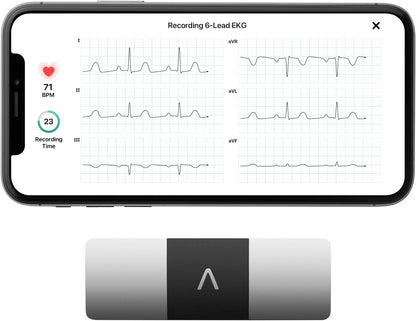 Portable ECG Monitor Bluetooth EKG Heart Tracker Device Accurate Fast Results 6-Lead with AFib Detection