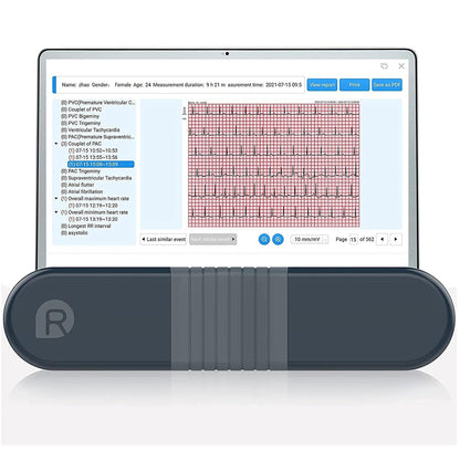 Personal ECG Device, Portable 24 Hours Holter Recorder with Heart Analysis Report Support PC Software Reliable Fast Results.