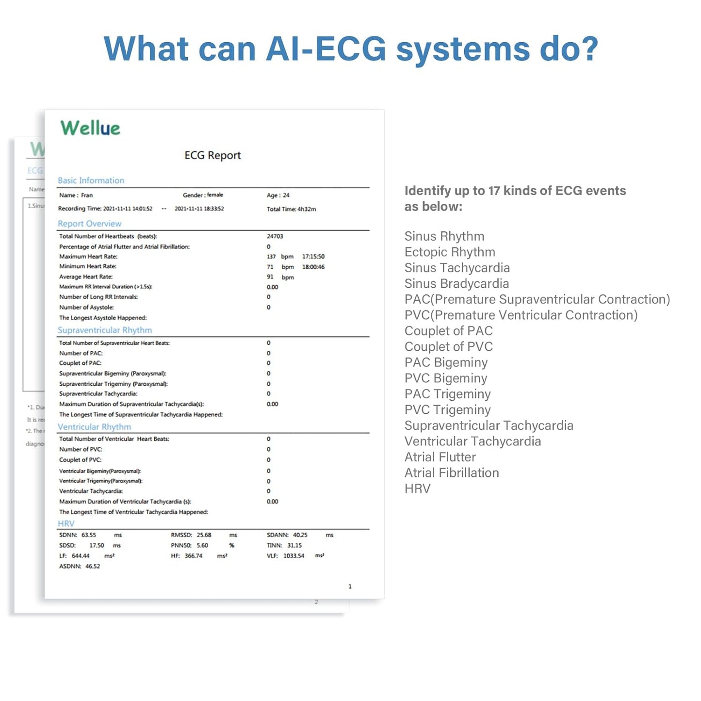 Professional ECG Machine, 24 Hours Holter Recording with AI Analysis, Works with Mac & Windows PDF Report, Portable Reliable Fast Results.