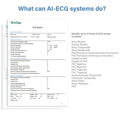 Professional ECG Machine, 24 Hours Holter Recording with AI Analysis, Works with Mac & Windows PDF Report, Portable Reliable Fast Results.