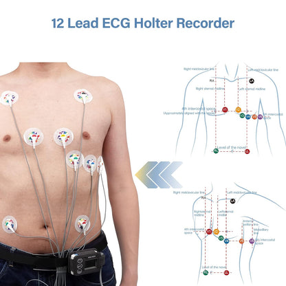 Professional ECG Machine, 24 Hours Holter Recording with AI Analysis, Works with Mac & Windows PDF Report, Portable Reliable Fast Results.